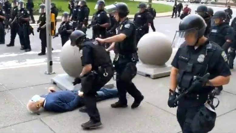 Trump sugere que caso de manifestante ferido por policiais pode ser montagem