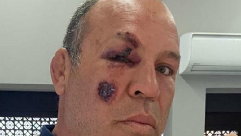 Reprodução/ Redes Sociais