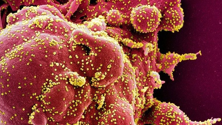 National Institute of Allergy and Infectious Diseases/AFP/Arquivos