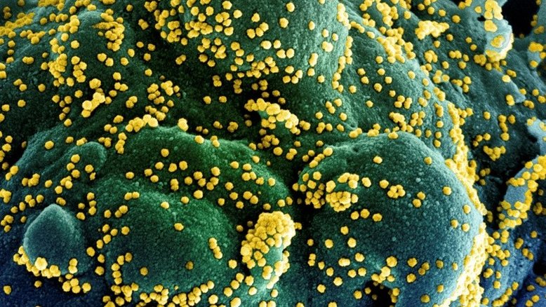 National Institute of Allergy and Infectious Diseases/AFP/Arquivos
