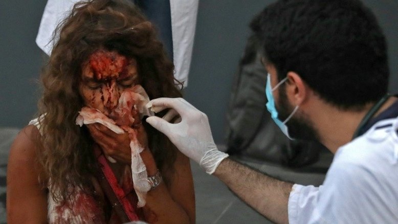 Em Beirute, cenas de caos em hospitais saturados