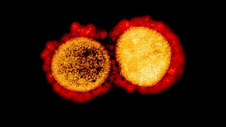 EUA está desenvolvendo cepa de coronavírus para 'testes de desafio' em humanos