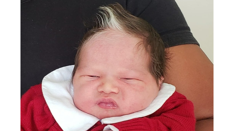 MG: Bebê nasce com mecha de cabelo branco e vira 'celebridade'
