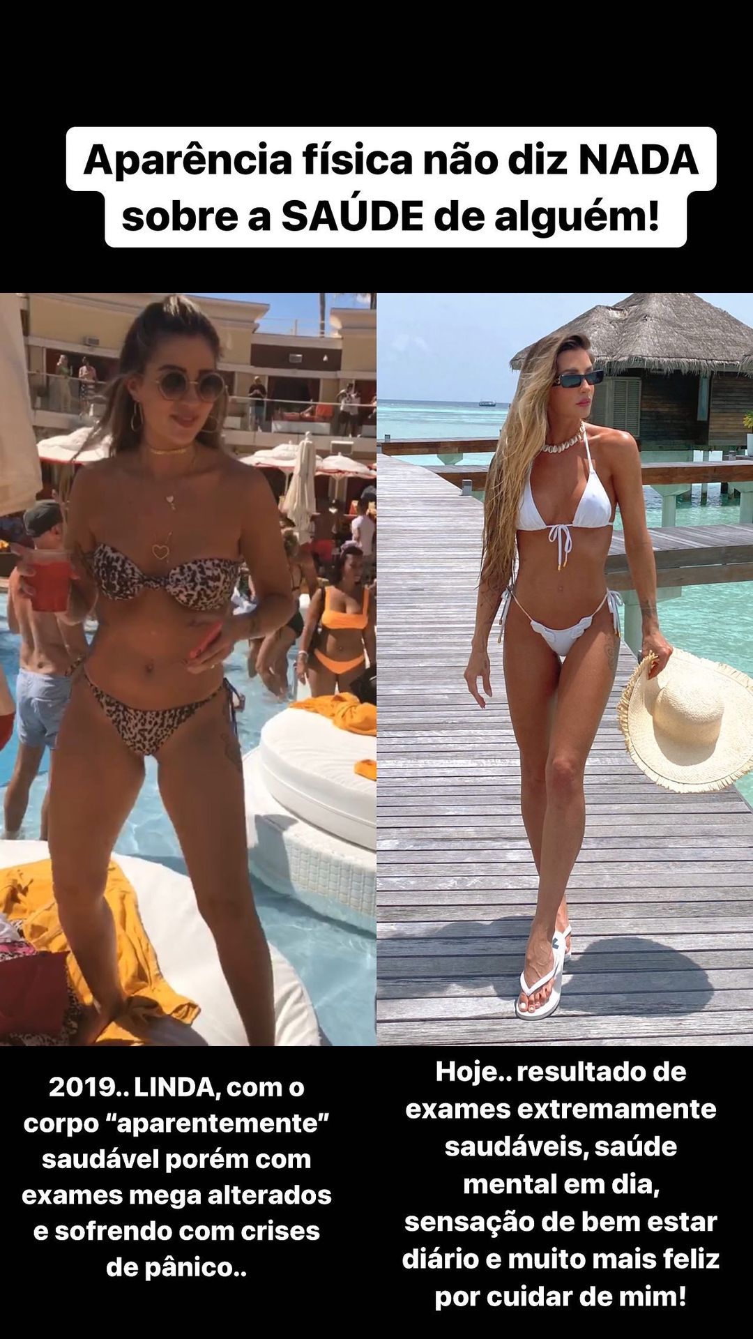 Após críticas, Aline Gotschalg mostra antes e depois: “Aparência não diz nada” 4 Após críticas, Aline Gotschalg mostra antes e depois: “Aparência não diz nada”