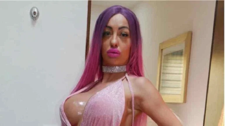 Mulher gasta R$ 85 mil para ter seios quatro vezes maiores e se inspira em modelo erótica