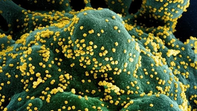 Covid-19 mata 768 pessoas em 24h no Brasil; número de óbitos ultrapassa os 190 mil