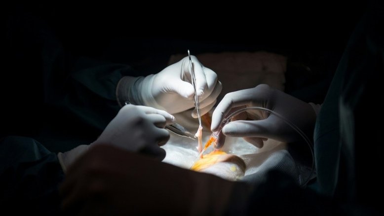 Transplante de órgãos: o que pode ser doado? Quem pode doar?
