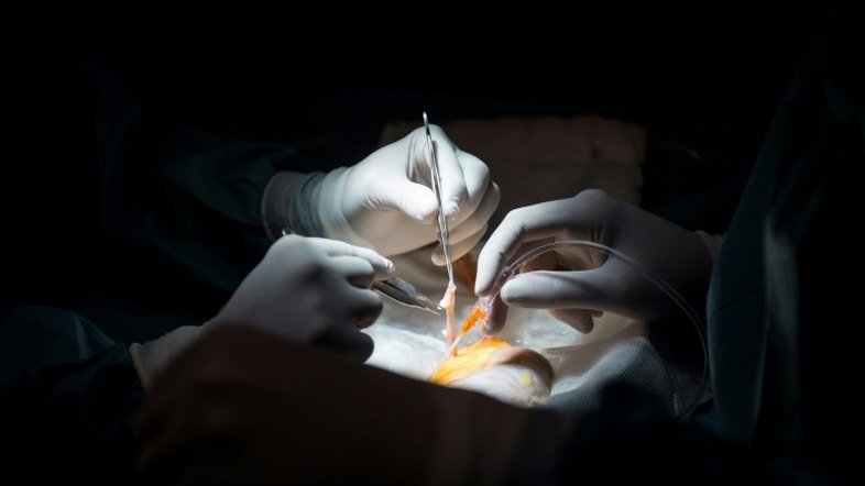Transplante de órgãos: o que pode ser doado? Quem pode doar?