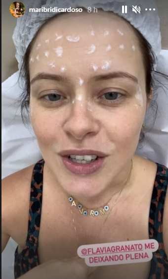 Mari Bridi aplica botox e mostra procedimento nas redes sociais 4 Mari Bridi aplica botox e mostra procedimento nas redes sociais