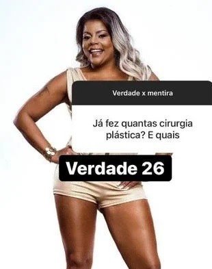 Tati Quebra Barraco diz ter feito 26 cirurgias plásticas no corpo 4 Tati Quebra Barraco diz ter feito 26 cirurgias plásticas no corpo