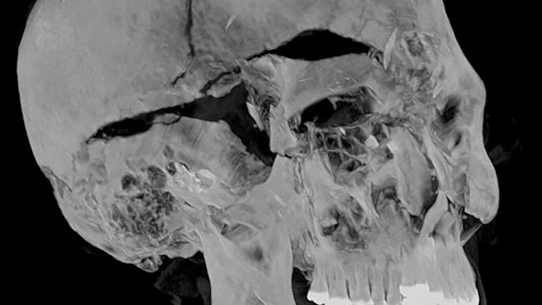 Tomografia no Egito revela as causas da morte de um faraó