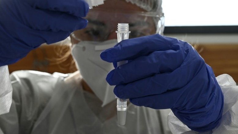 França detecta quatro casos da variante brasileira do coronavírus