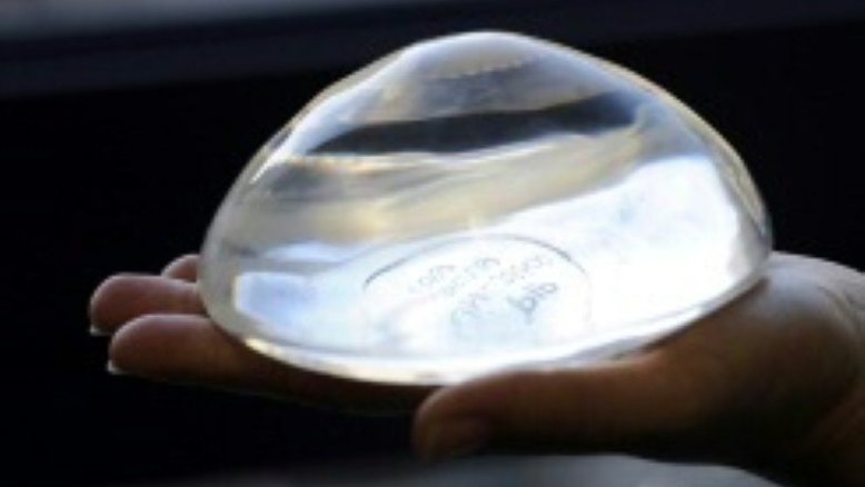 Médicos dizem que moda e alarmismo aumentaram a retirada de silicone