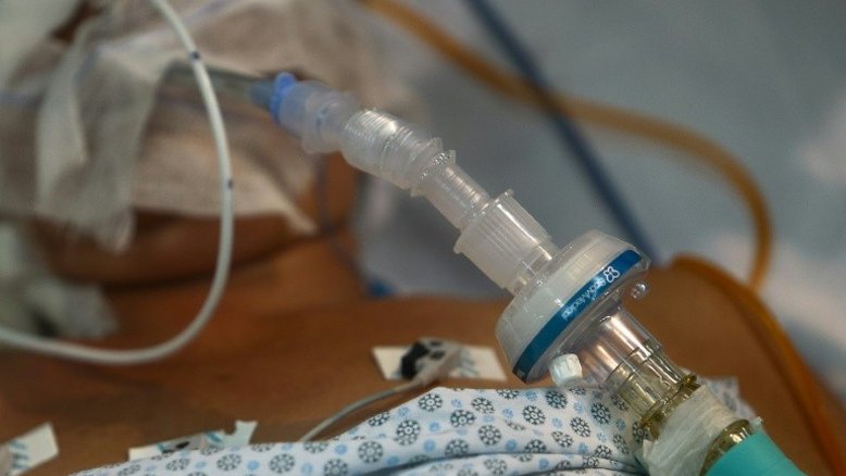 Mais de 80% de mortalidade entre intubados com covid-19 no Brasil (estudo)