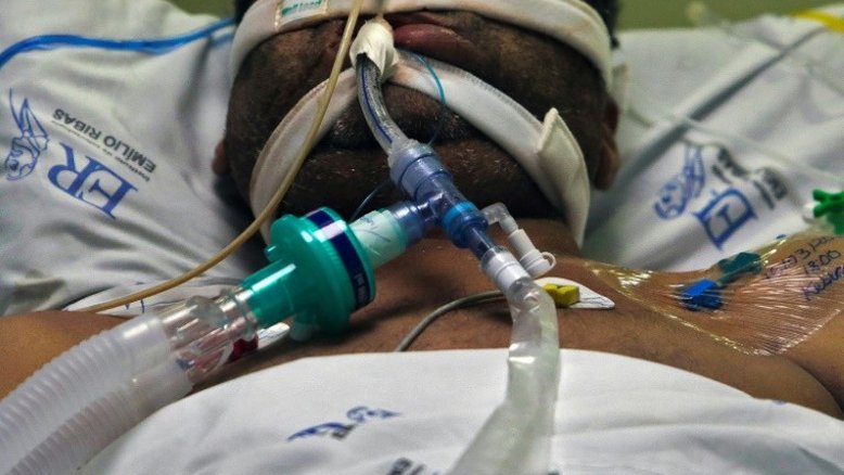 Um paciente com covid-19 permanece na Unidade de Terapia Intensiva do Hospital Emilio Ribas em São Paulo, 17 de março de 2021 - AFP