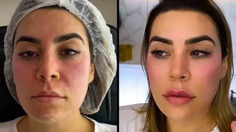 Reprodução/Instagram