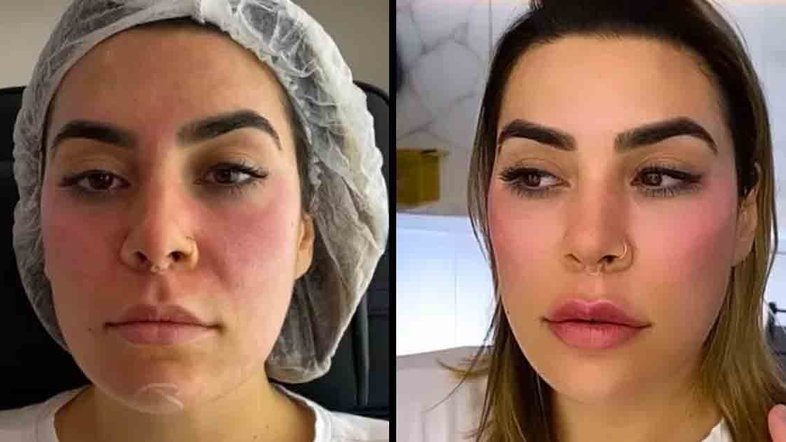 Reprodução/Instagram