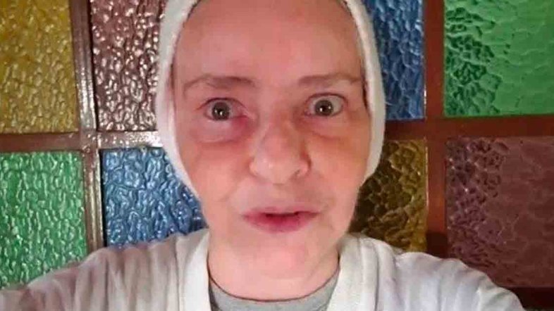 Angela Ro Ro agradece tratamento na rede pública após levar pontos na cabeça