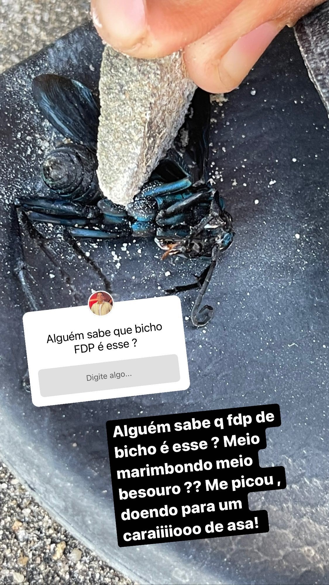 No Limite: André Marques é picado por inseto e reclama de dor