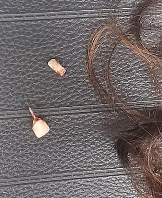 Mantida em cárcere por 9 horas, mulher é agredida e tem dois dentes quebrados em Piracicaba (SP)