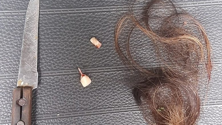 Mantida em cárcere por 9 horas, mulher é agredida e tem dois dentes quebrados em Piracicaba (SP)