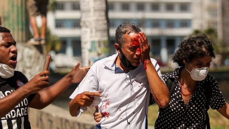 Governo de Pernambuco vai indenizar feridos em manifestação contra Bolsonaro