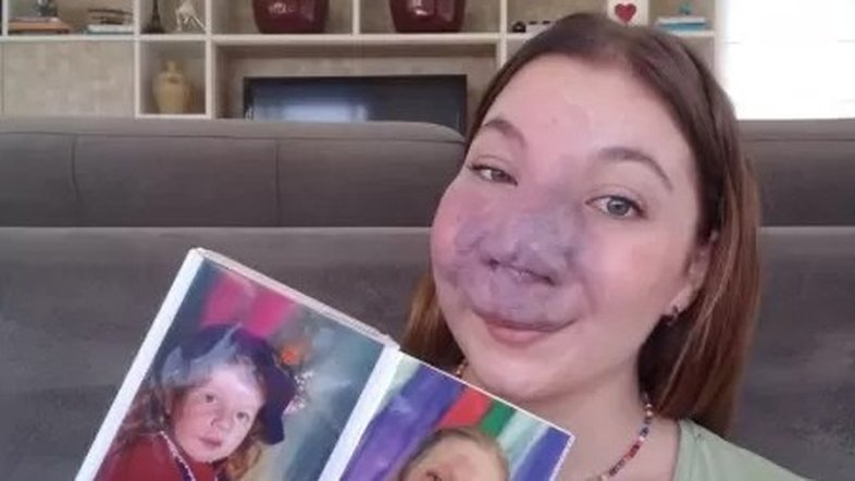 Nutricionista transformou bullying da infância em luta por autoestima feminina