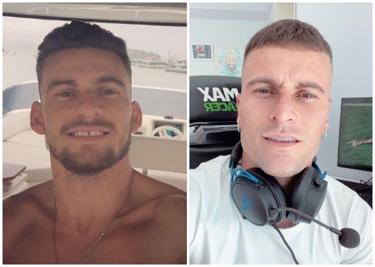 Lucas Lima, do Palmeiras, faz harmonização facial e surge irreconhecível