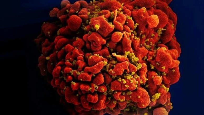 Após 40 anos de pesquisa sobre a aids, em que ponto está a vacina?