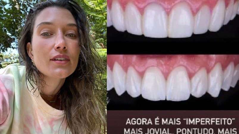Gabriela Pugliesi muda lentes de contato e faz procedimento para dentes ficarem 'imperfeitos'