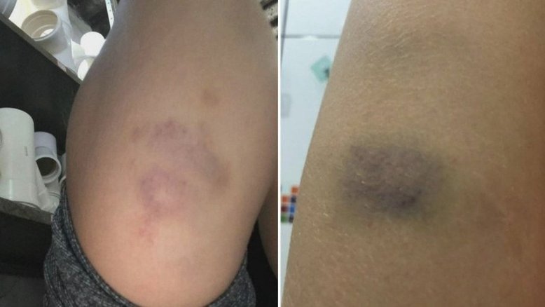 Adolescente de 16 anos é suspeito de estuprar cunhada de 13 e agredir namorada em Goiás