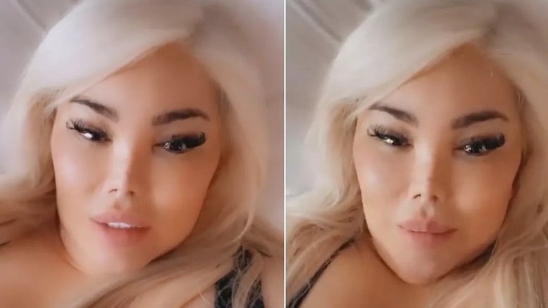 Jessica Alves faz cirurgia bariátrica: 'Estou ótima'
