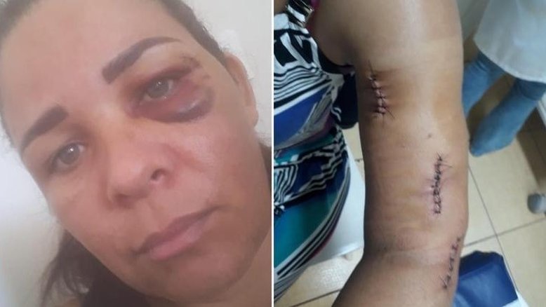 Mulher é espancada após pedir para cliente usar máscara
