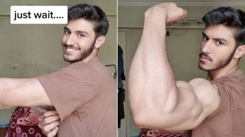 Vídeo: Estudante é comparado a Popeye após exibir braço musculoso em antes e depois