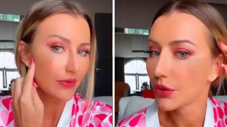 Ana Paula Siebert mostra curativo no rosto após procedimento