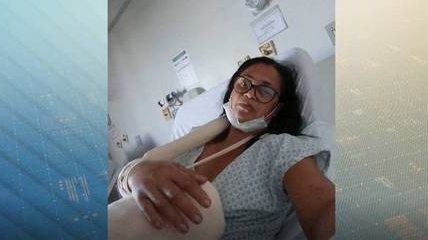 Mulher segue sem conseguir operar mesmo após dez meses de ataque de pitbull