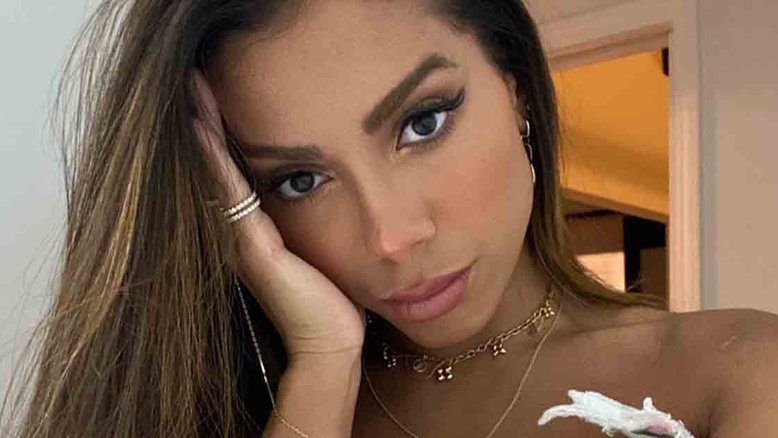 Anitta mostra machucados nas pernas durante ensaio para premiação