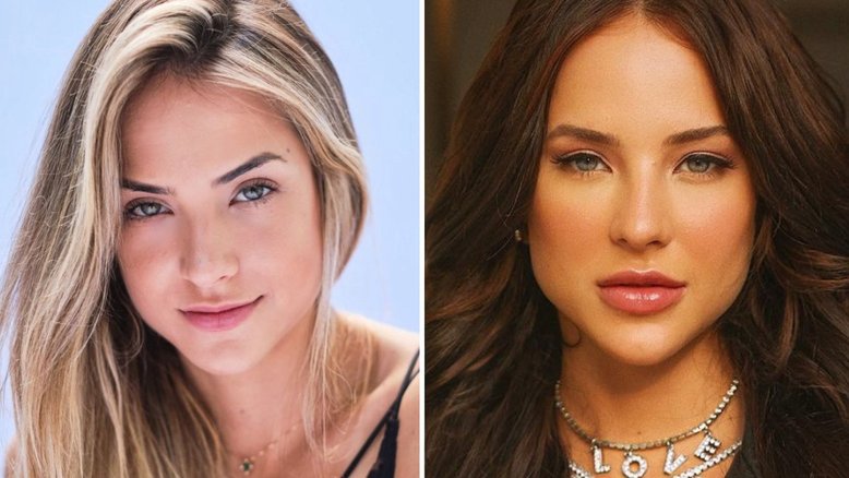 Antes e depois: veja os famosos que fizeram harmonização facial