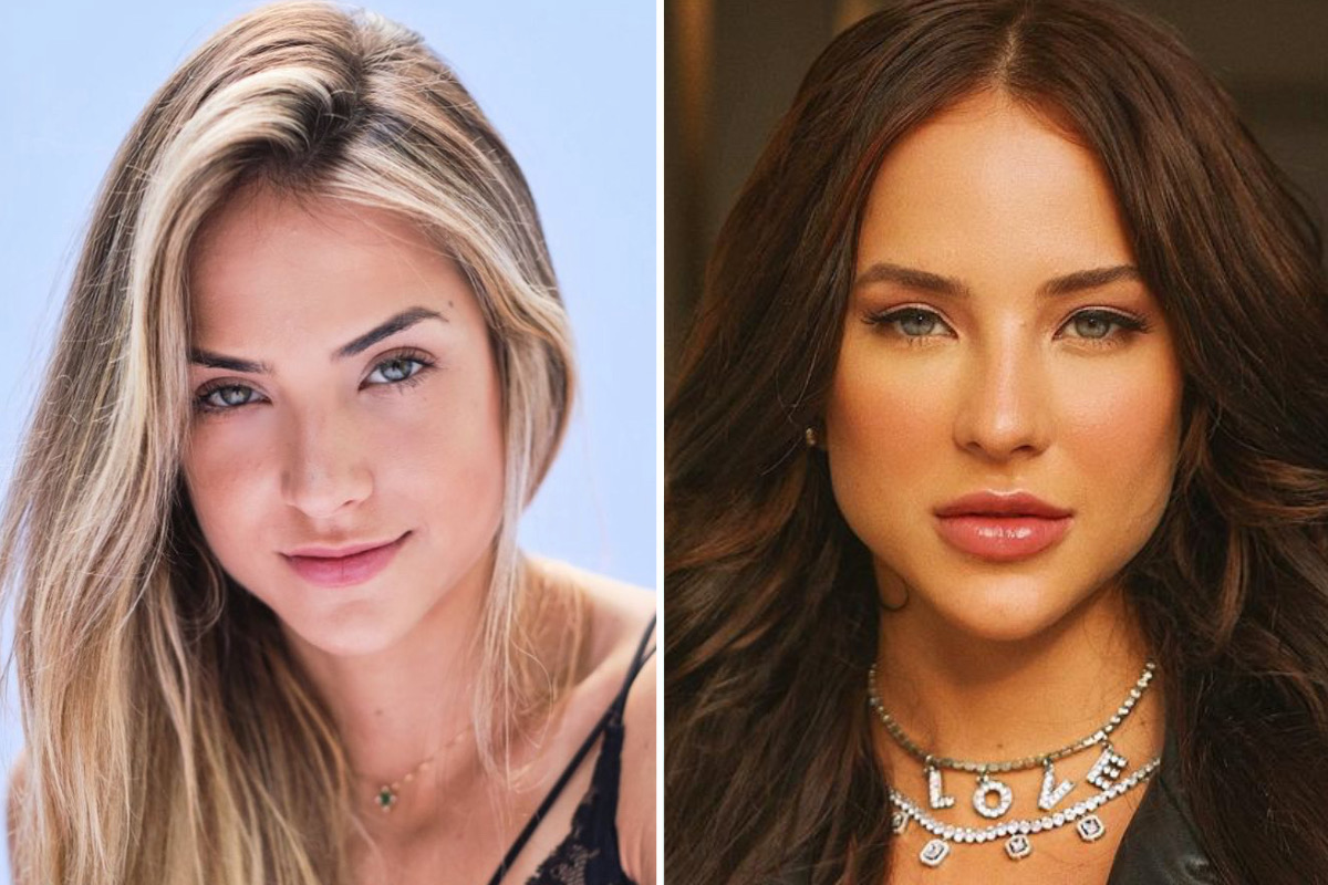 Antes e depois: veja os famosos que fizeram harmonização facial