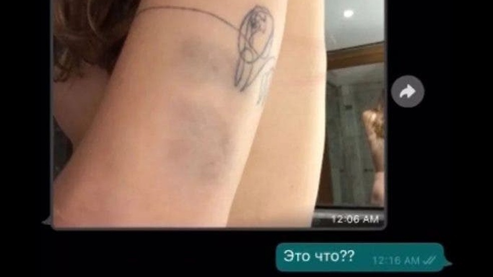 Ex-namorada revela novo caso de agressão de Zverev: 'Ele me socou na cara e nos braços'