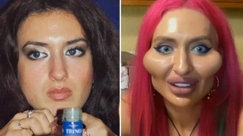 'Monstro bonito', define-se modelo com maiores maçãs do rosto do mundo