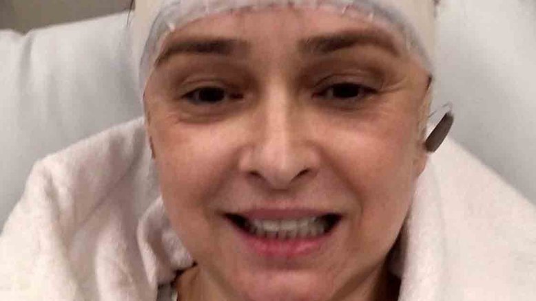 Myrian Rios detalha cirurgia na cabeça para retirar aparelhos auditivos