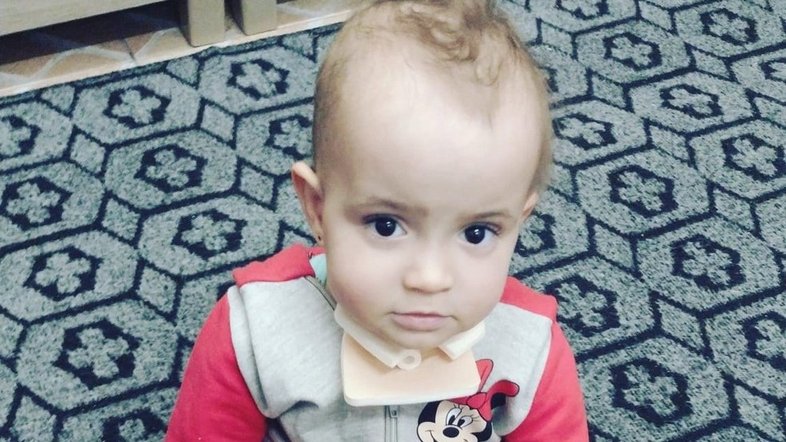 Bebê nasceu com 500g e precisa de 9 cirurgias, mas falta dinheiro para tratamento