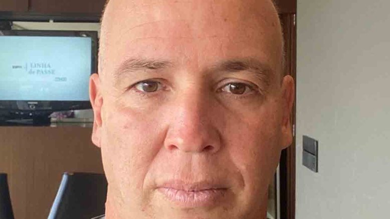 Caio Ribeiro posta foto careca após início de tratamento contra câncer