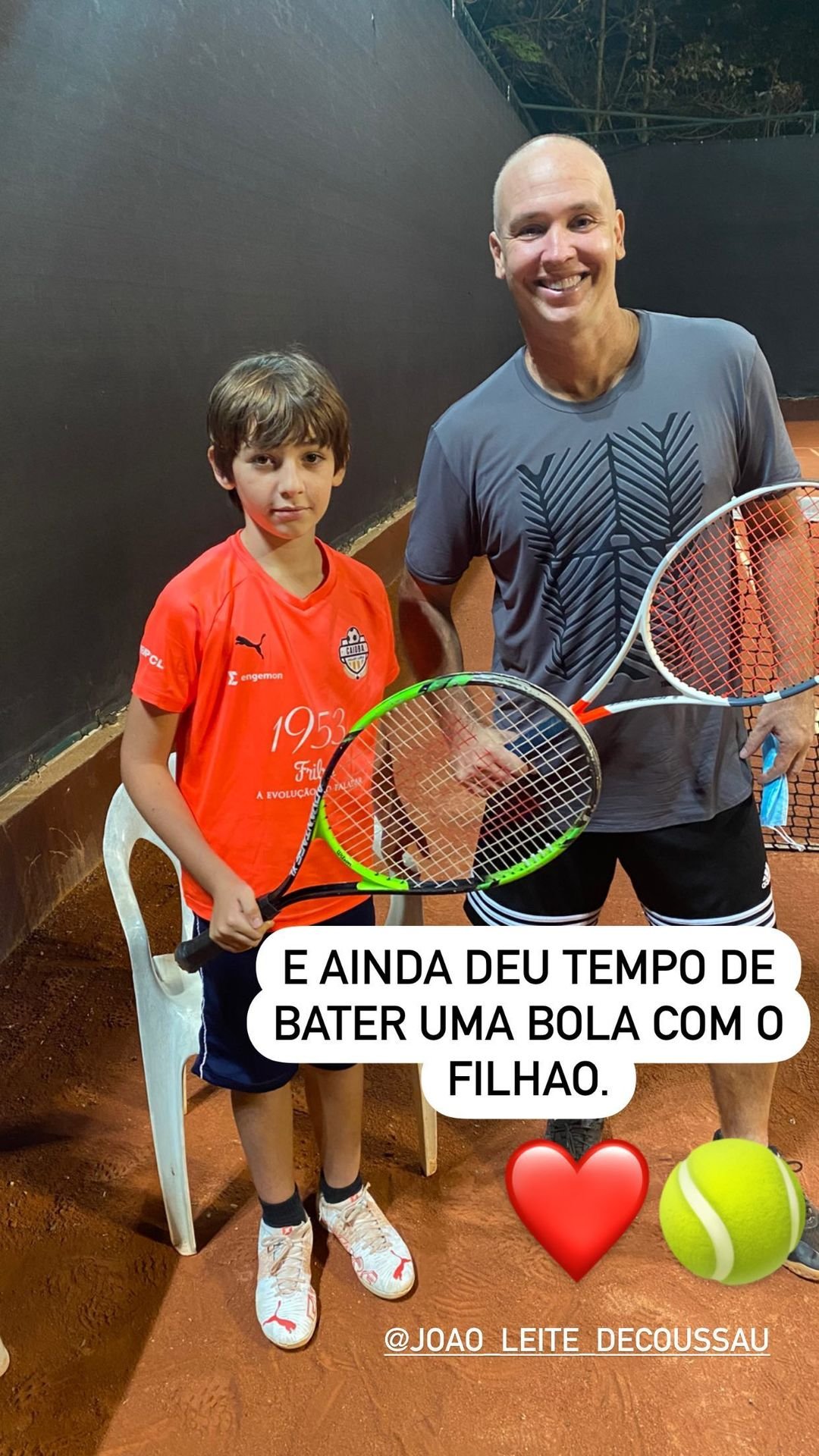 Caio Ribeiro posta foto careca após início de tratamento contra câncer