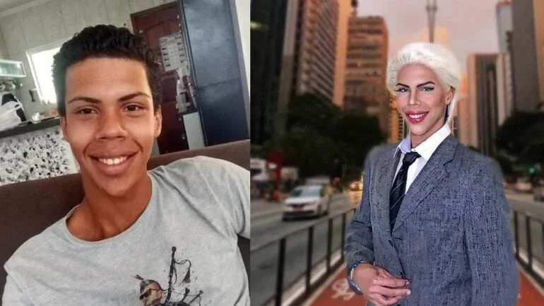 Jovem desiste de cirurgias para ser 