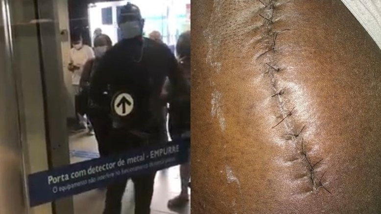 Homem diz que precisou abaixar calça para mostrar cicatriz e entrar em banco no ES