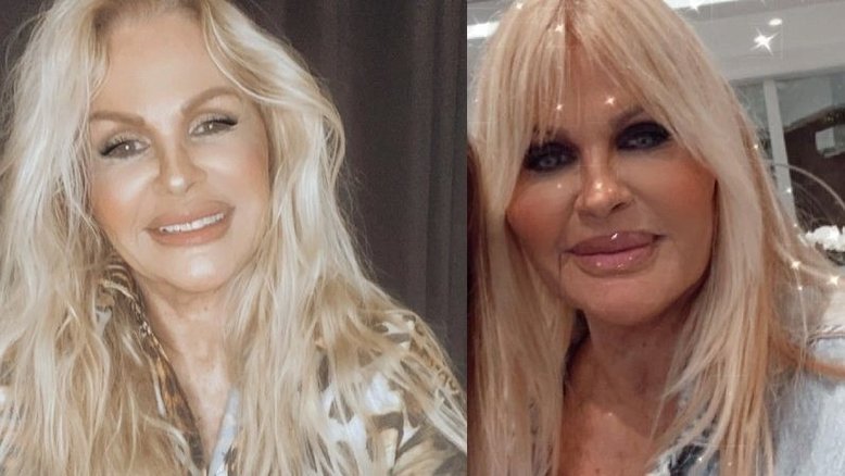 Monique Evans é criticada por uso exagerado de procedimentos faciais: 'Muito artificial'