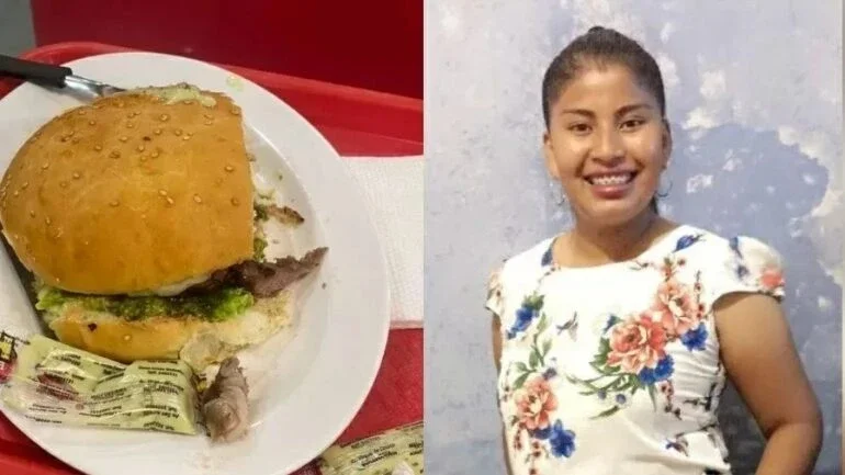 Boliviana encontra dedo em sanduíche, e restaurante diz que houve acidente de trabalho