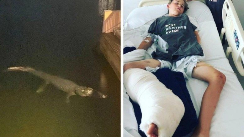 Crocodilo ataca criança de 12 anos em Cancún